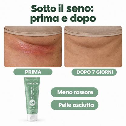 Sotto il seno: prima e dopo